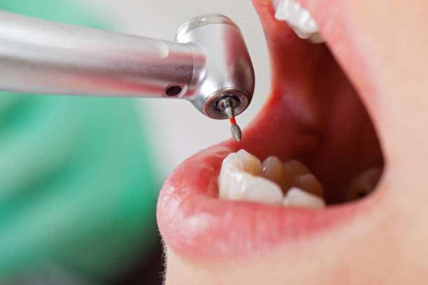 Best Emergency Denture Repair in St Michaels, MD